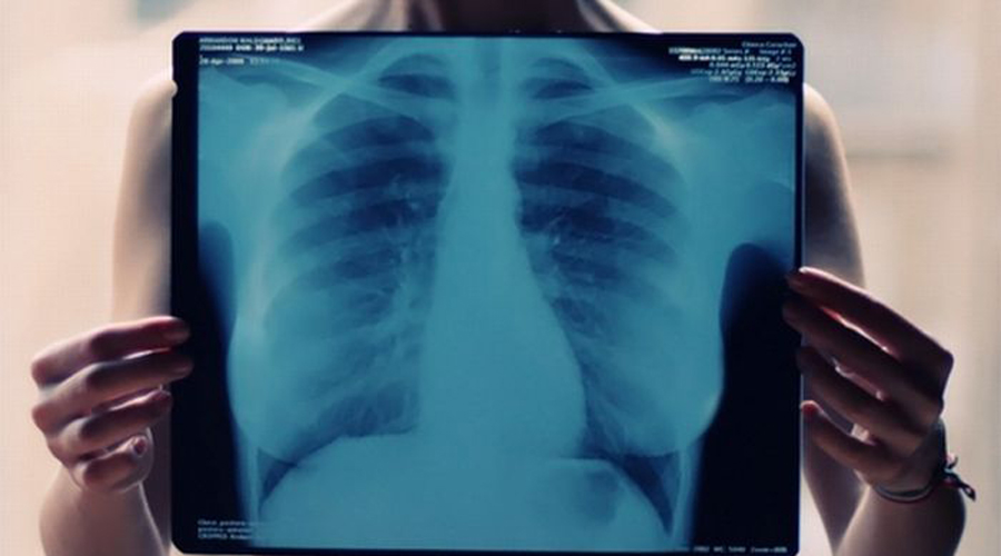 ¿En qué casos es peligroso hacerse una radiografía? | El Imparcial de Oaxaca
