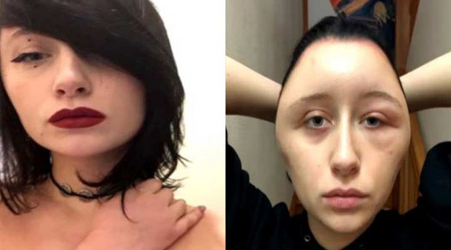 Francesa termina con la cara deforme tras pintarse el cabello | El Imparcial de Oaxaca