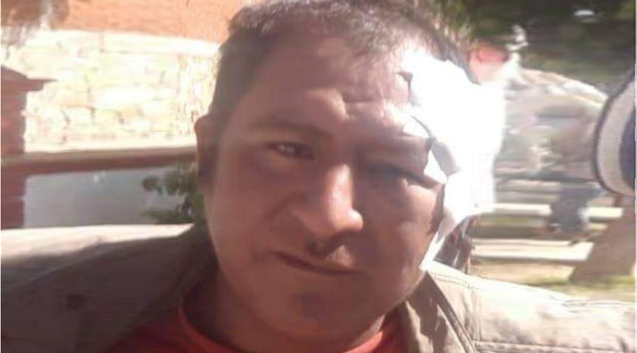 Mototaxista atropella a trabajador en San Pedro Ixtlahuaca | El Imparcial de Oaxaca