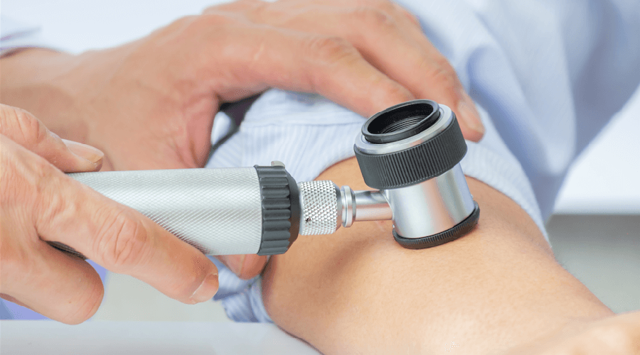 Alertan por aumento en casos de cáncer de células de Merkel