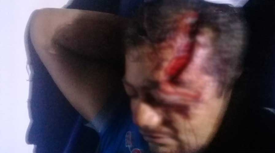 Motociclista alcoholizado derrapa y se lesiona la cara | El Imparcial de Oaxaca