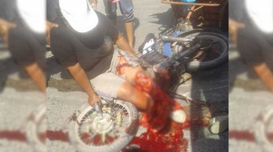 Autobús atropella a mujer y le tritura pierna en Juchitán | El Imparcial de Oaxaca