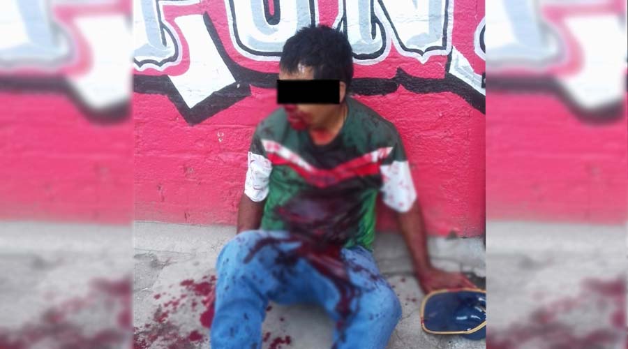 A navajazos lesionan a limpiaparabrisas de Huajuapan de León | El Imparcial de Oaxaca