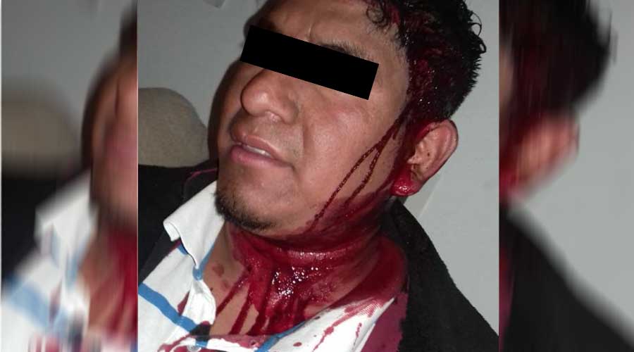 Enfrentamiento entre transportistas deja lesionados en Tlaxiaco | El Imparcial de Oaxaca