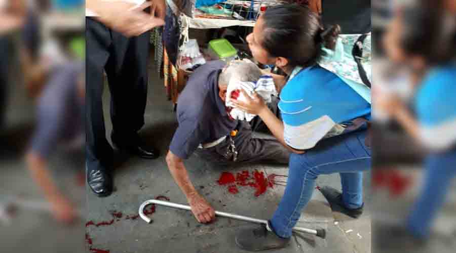Se lesionan hombres al caer en la Central de Oaxaca