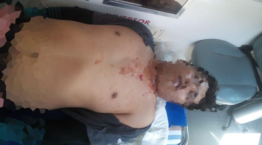 Matan a balazos a joven poblano durante asalto en Juchitán | El Imparcial de Oaxaca