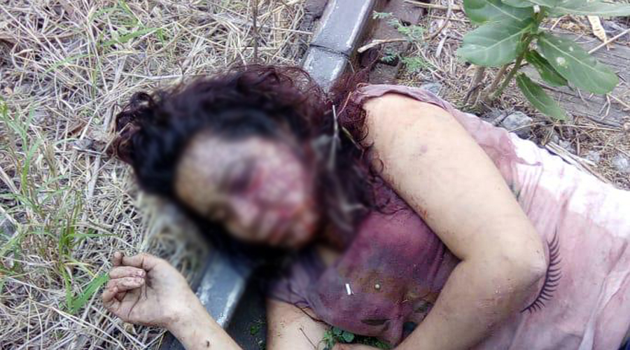 Mujer agredida en Salina Cruz requiere de ayuda | El Imparcial de Oaxaca