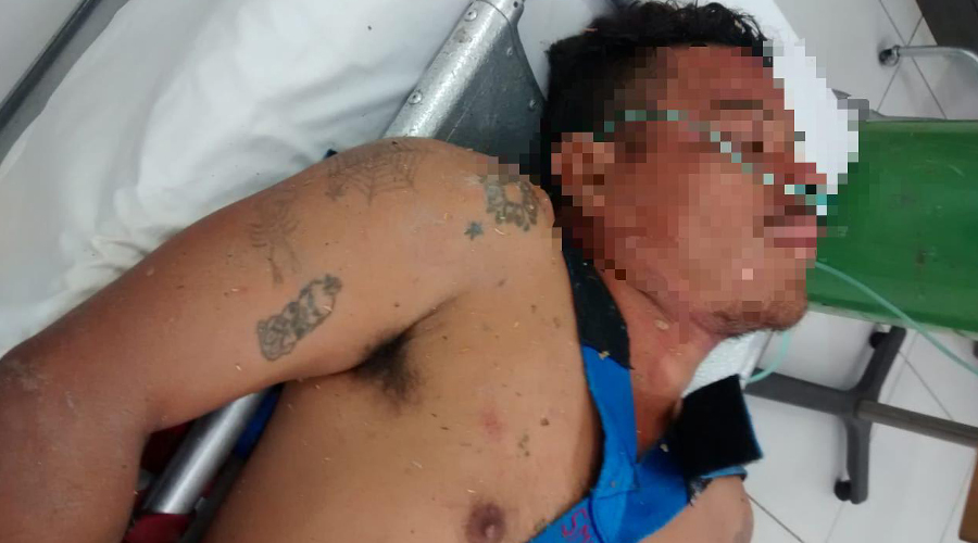 Atienden a hombre por sobredosis en Huatulco | El Imparcial de Oaxaca