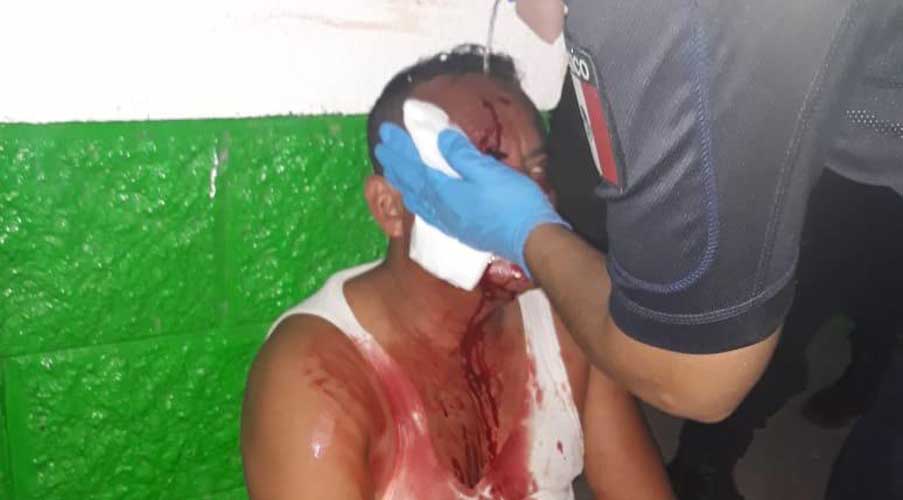 Lesionan a hombre con botellazo en la cabeza tras riña