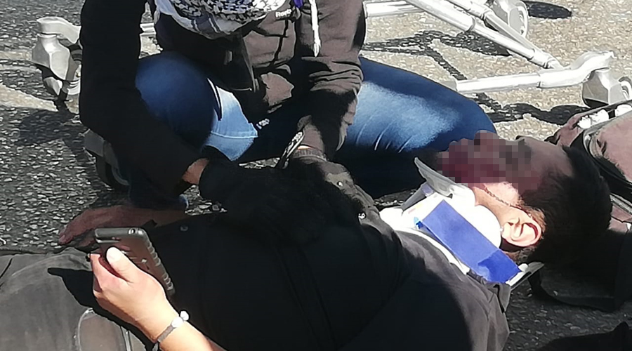 Se lesiona motociclista al ser impactado por auto en Viguera | El Imparcial de Oaxaca