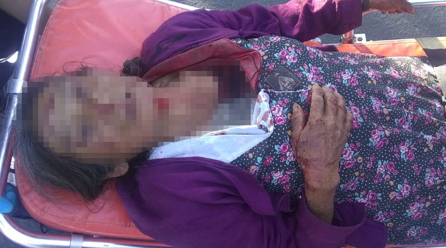 Atropellan a mujer de la tercera edad en Atzompa