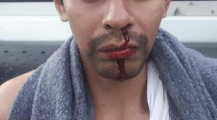 Golpean a hombre acusado de manosear a niña