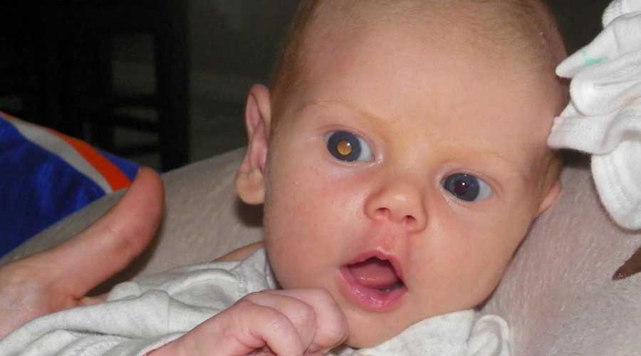 ¿Sueles tomar fotos a tus niños?, podrían ayudarte a detectar cáncer ocular