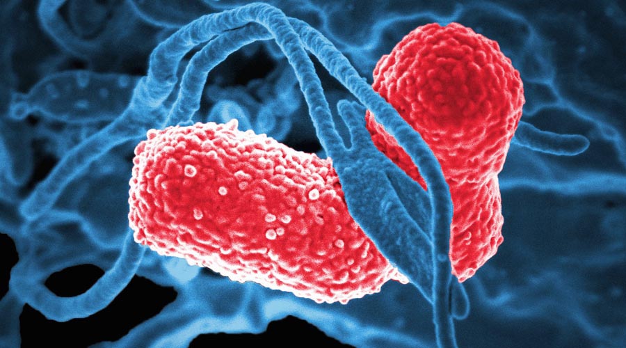 Esta infección podría causarte la muerte en solo un día