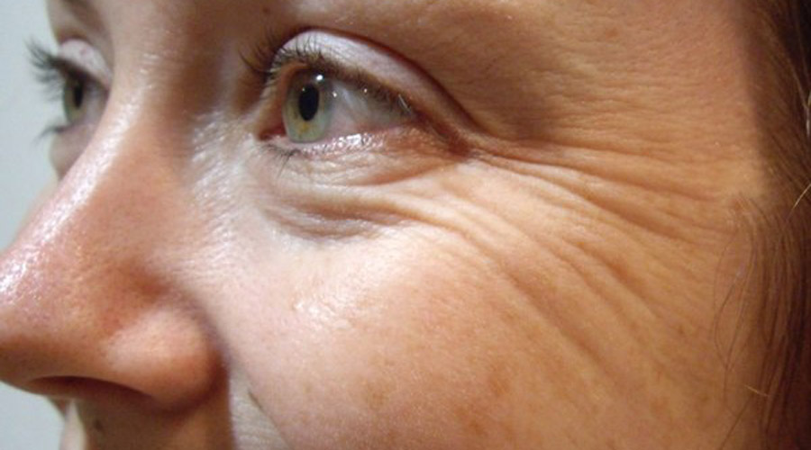 Cómo cuidar el contorno de ojos para evitar arrugas prematuras | El Imparcial de Oaxaca