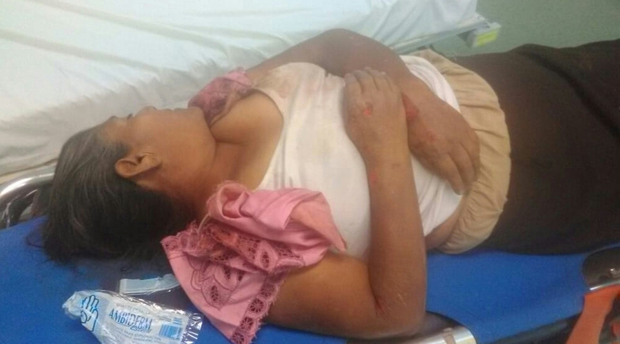 Muere mujer en el hospital tras accidentarse en moto | El Imparcial de Oaxaca