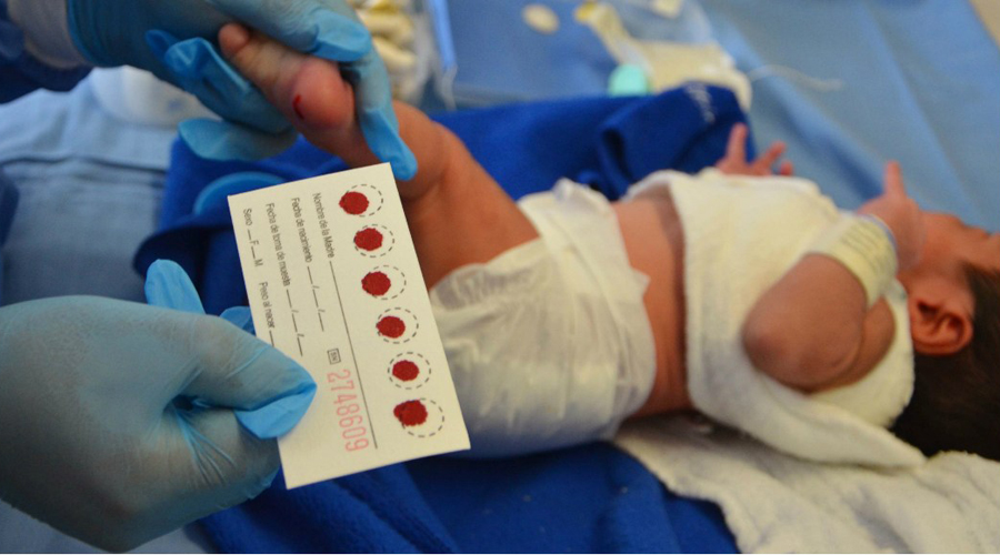 En 2018 siete niños murieron por fibrosis quística en Oaxaca