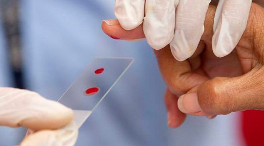 ¿Cuáles son los tipos de hemofilia y cómo tratarla? | El Imparcial de Oaxaca
