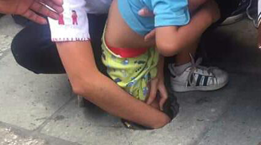 Niño cae en registro abierto y se lesiona la pierna | El Imparcial de Oaxaca