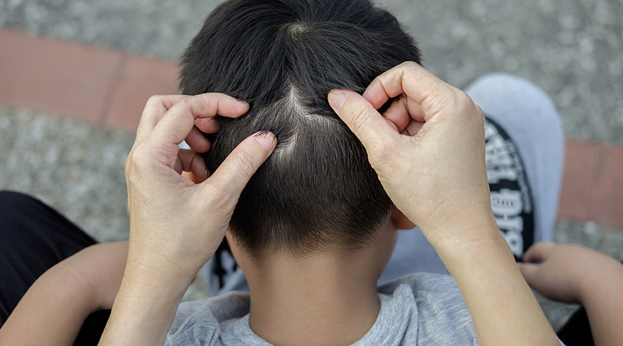 Reportan brotes de pediculosis en Oaxaca