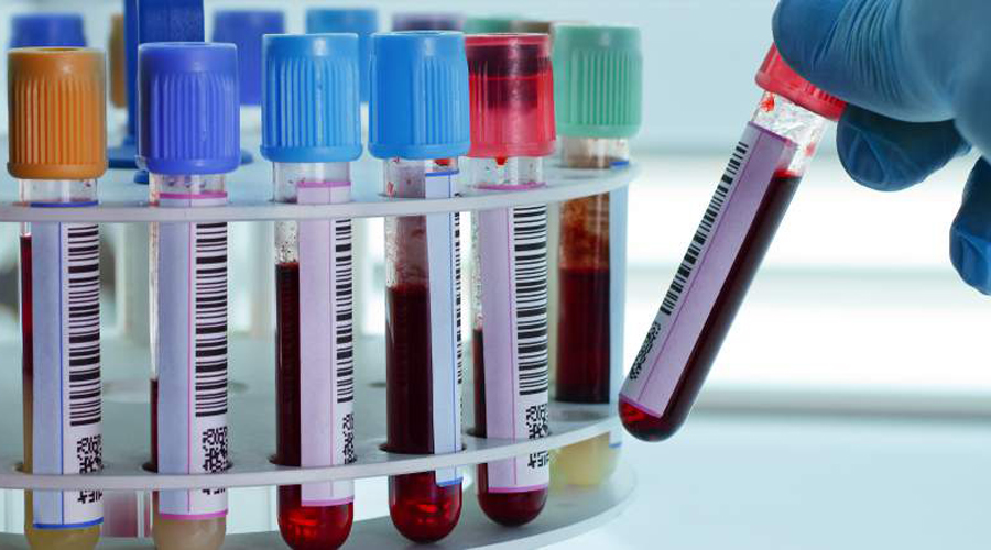 Prueba de sangre detectaría fatiga crónica