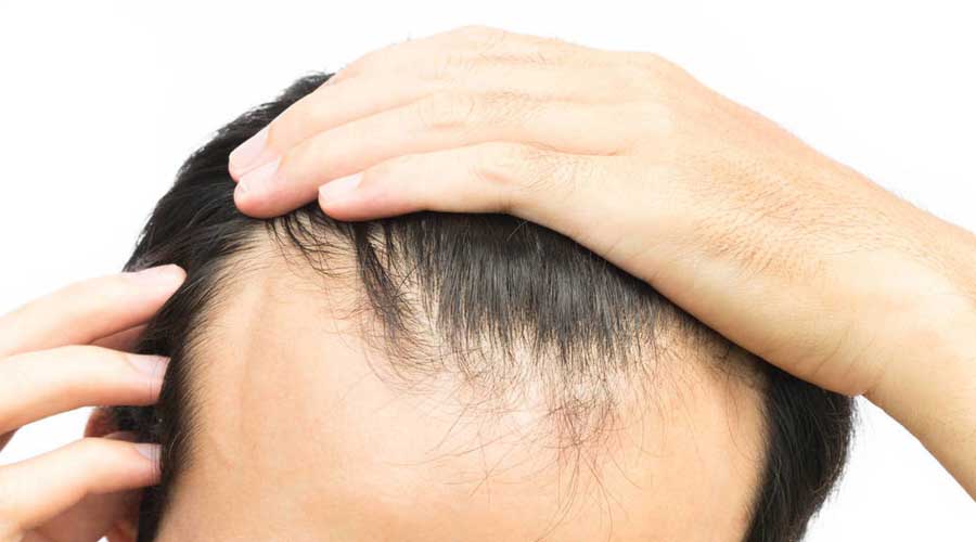 Las enfermedades que pueden causar pérdida de cabello