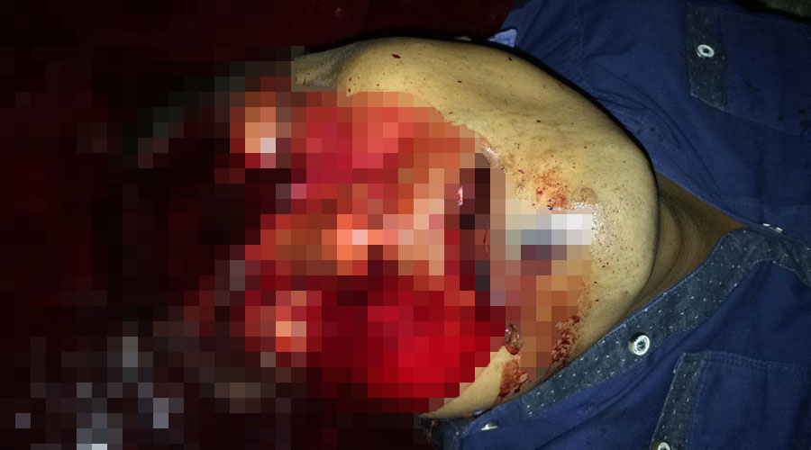 Sicarios ejecutan a albañil en Santa María Petapa | El Imparcial de Oaxaca