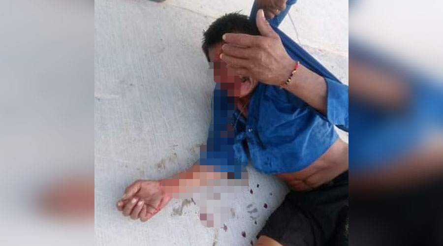 Quería asaltar a un joven y le responde con una brutal golpiza | El Imparcial de Oaxaca