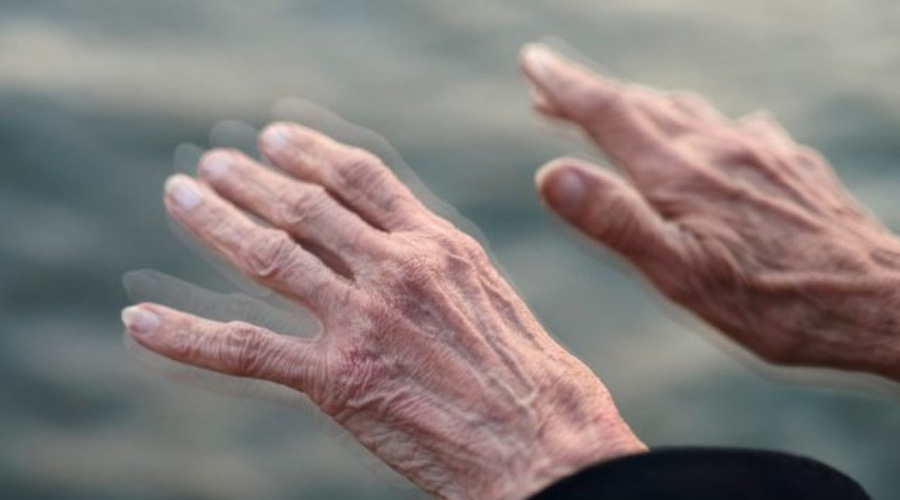 Estos cuatro síntomas podrían predecir el padecimiento de Parkinson | El Imparcial de Oaxaca