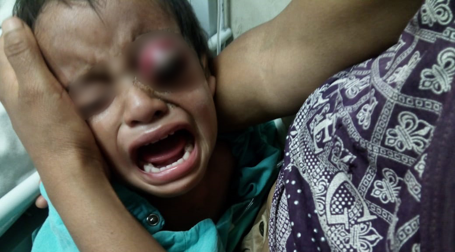 En la Mixteca niño de dos años sufre violencia física