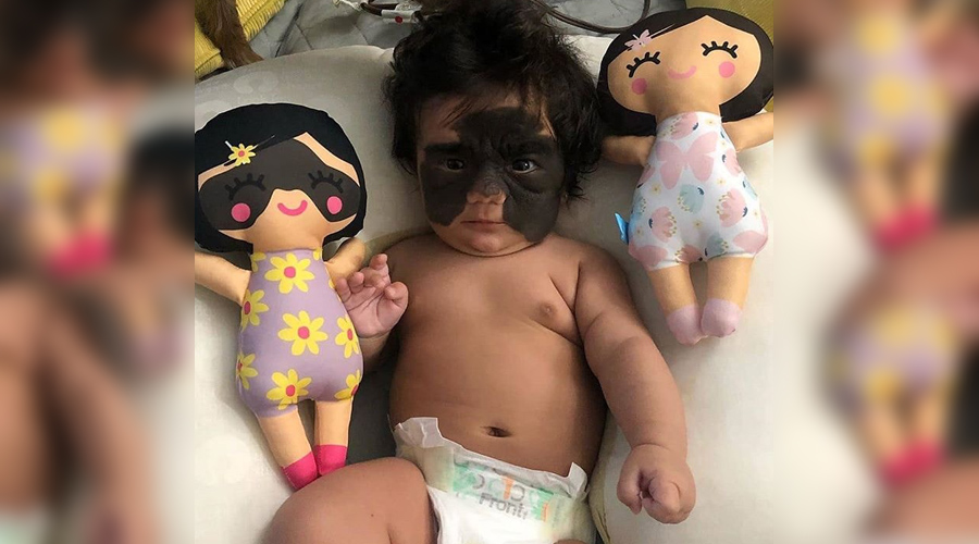 Conoce a la “Batibeba”, la bebé que enternece redes sociales con su marca de nacimiento