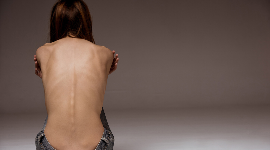 Estudios determinan que anorexia también es genética | El Imparcial de Oaxaca
