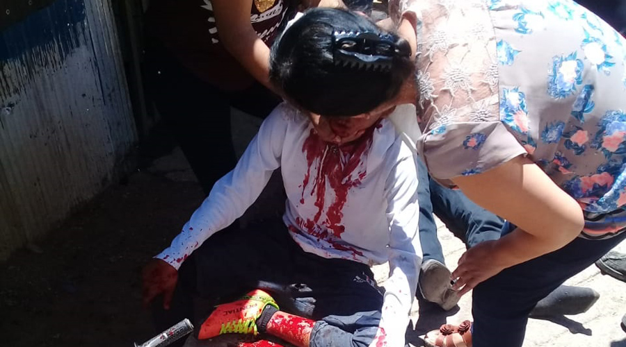 Menores se impactan contra poste en San Juan Chapultepec