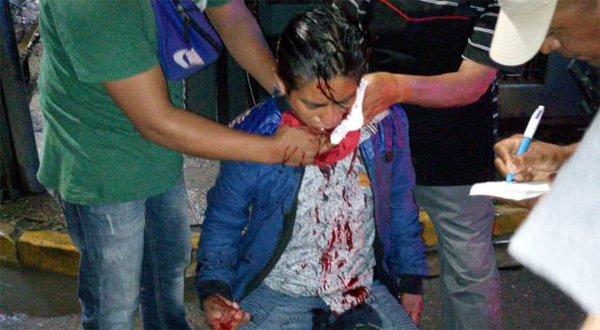 Atacan a hombre con un picahielo en pleno centro de la ciudad de Oaxaca | El Imparcial de Oaxaca