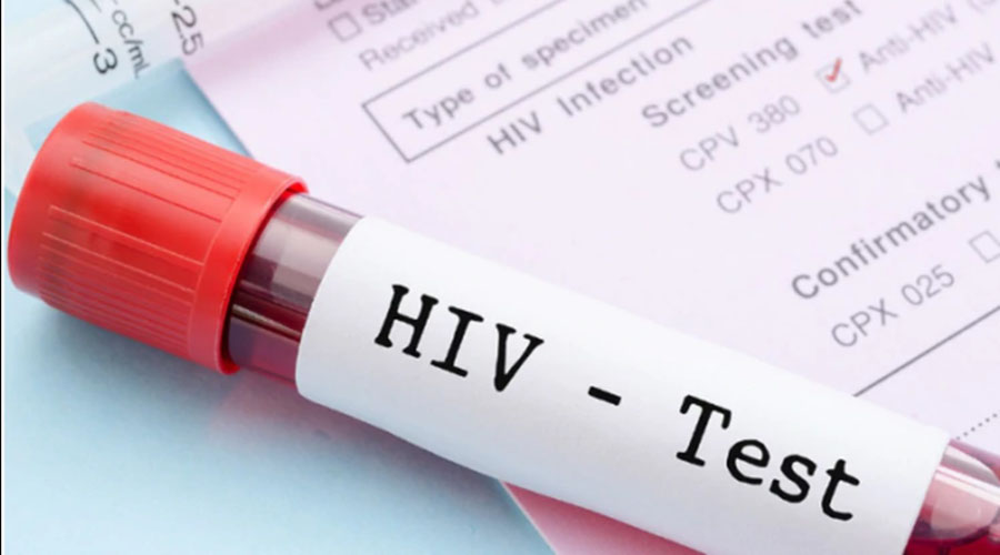 Alertan por nuevo reto viral que invita a tener sexo sin protección con portadores de VIH