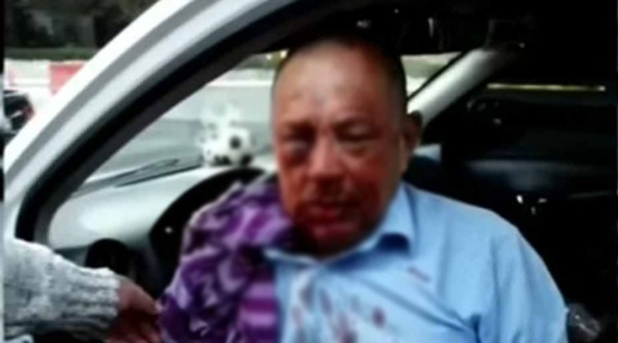 Matan a golpes a taxista con tal de no pagarle el viaje | El Imparcial de Oaxaca