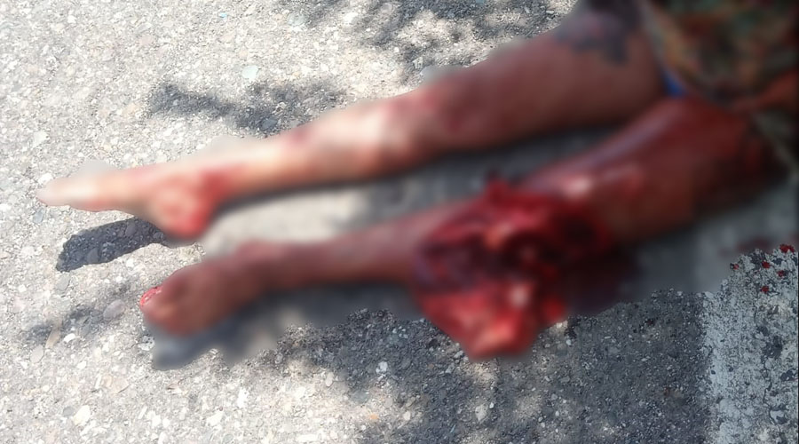 Roba moto y se cercena la pierna cerca de Petapa | El Imparcial de Oaxaca