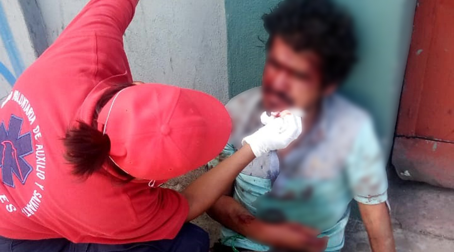 Durante la parranda mujer ataca a su pareja en calzada Madero