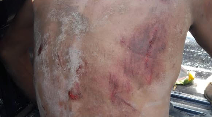Otro ejecutado en Tuxtepec; van 71 en este año
