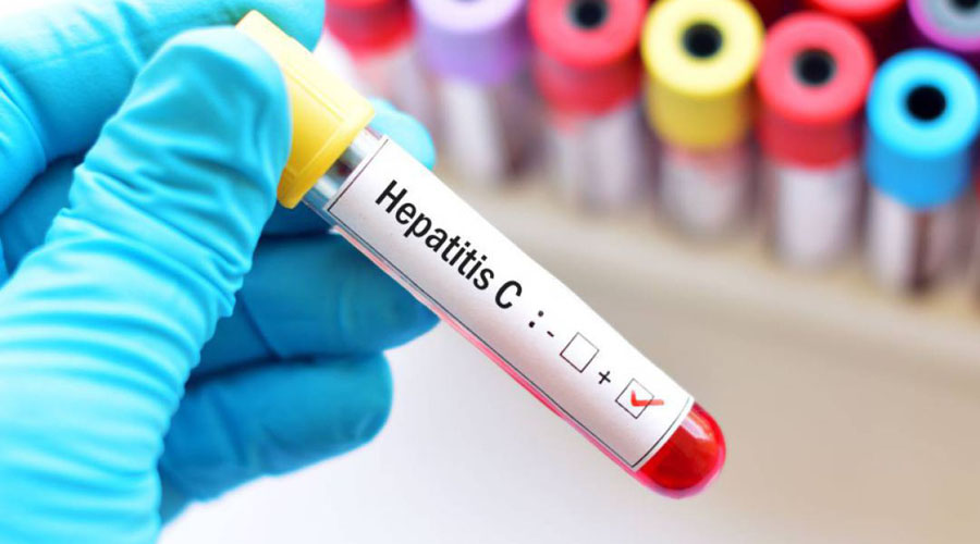 Los síntomas que indican Hepatitis C | El Imparcial de Oaxaca