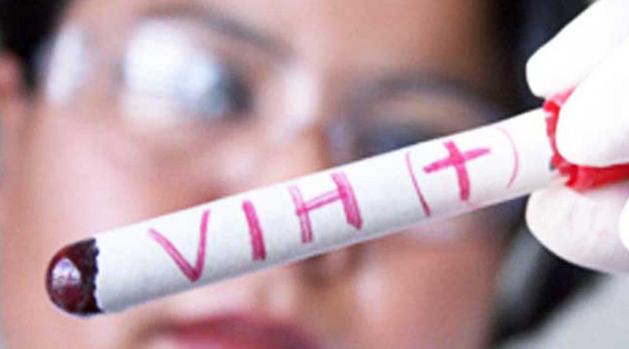 Capasit detecta 73 casos nuevos de VIH entre los jóvenes