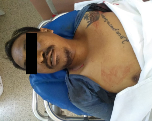 Identifican a mecánico asesinado a balazos en Pinotepa | El Imparcial de Oaxaca