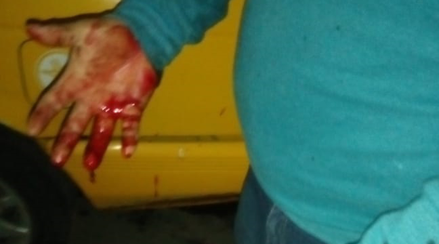 Lesionan a taxista tras resistirse a un asalto | El Imparcial de Oaxaca