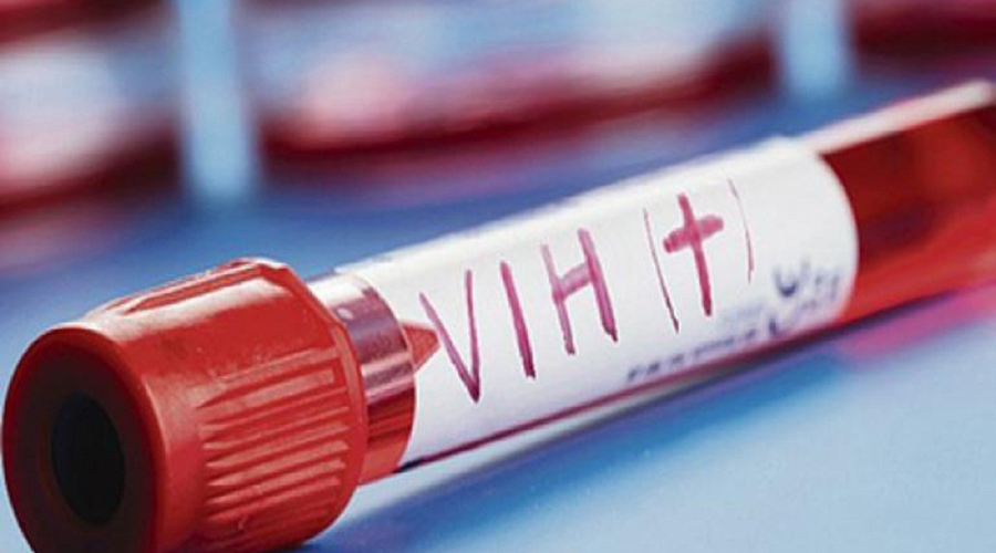 Científicos identifican nueva cepa del VIH | El Imparcial de Oaxaca