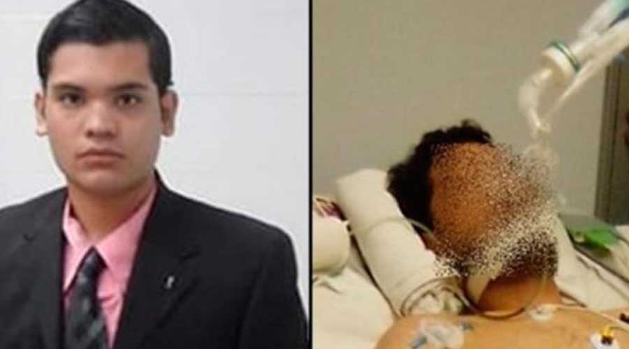 Proyectan buena recuperación de becario accidentado en Tuxtepec | El Imparcial de Oaxaca