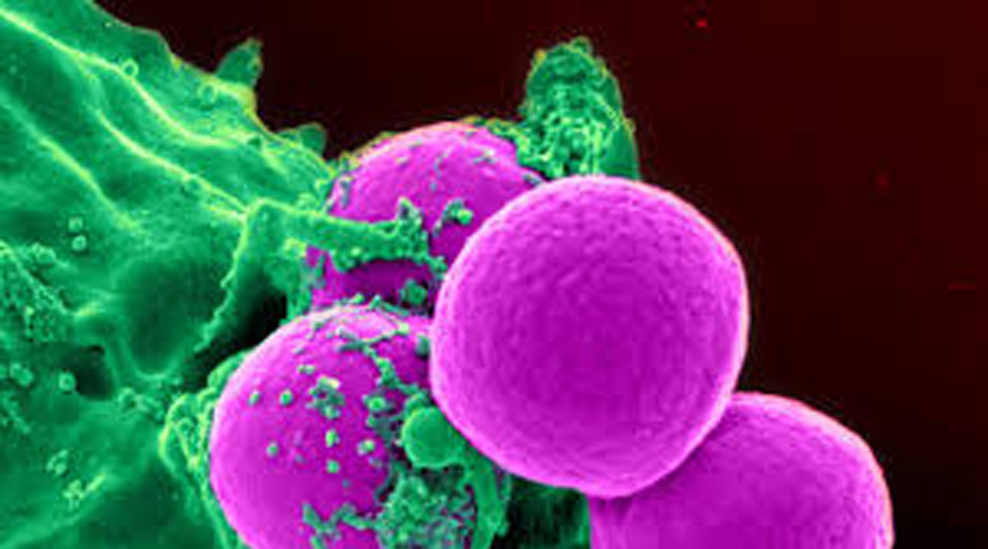 ¿Sabías que los microbios del intestino pueden predecir nuestra muerte?