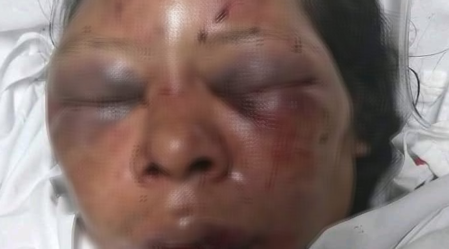 Hallan a mujer y su menor hija golpeadas e inconscientes en hotel | El Imparcial de Oaxaca