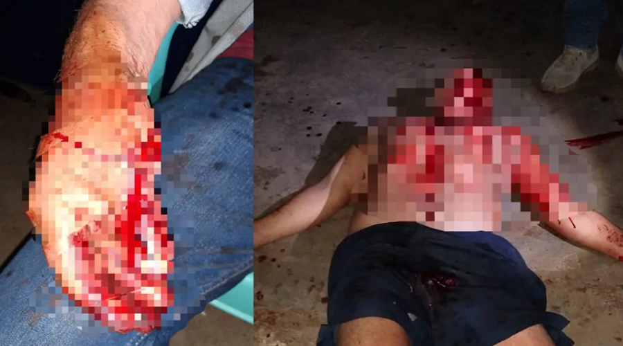 Riña a machetazos deja a dos heridos en Veracruz | El Imparcial de Oaxaca