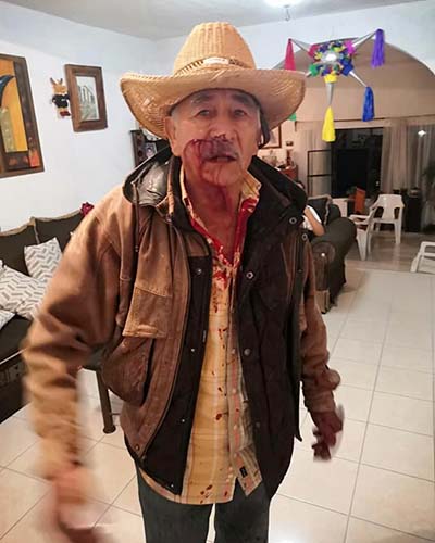 Hombre es atacado a machetazos por vecino en Etla | El Imparcial de Oaxaca