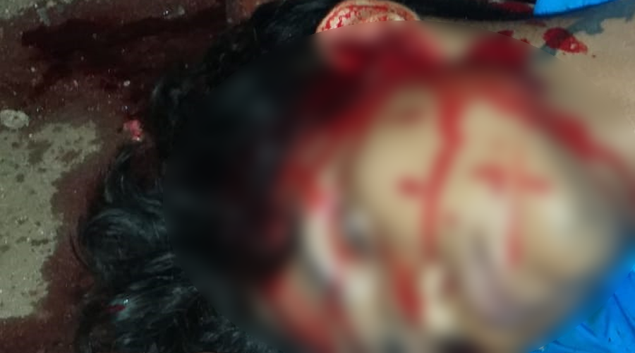 En Pinotepa ejecutan a jovencito de dos balazos en la cabeza | El Imparcial de Oaxaca
